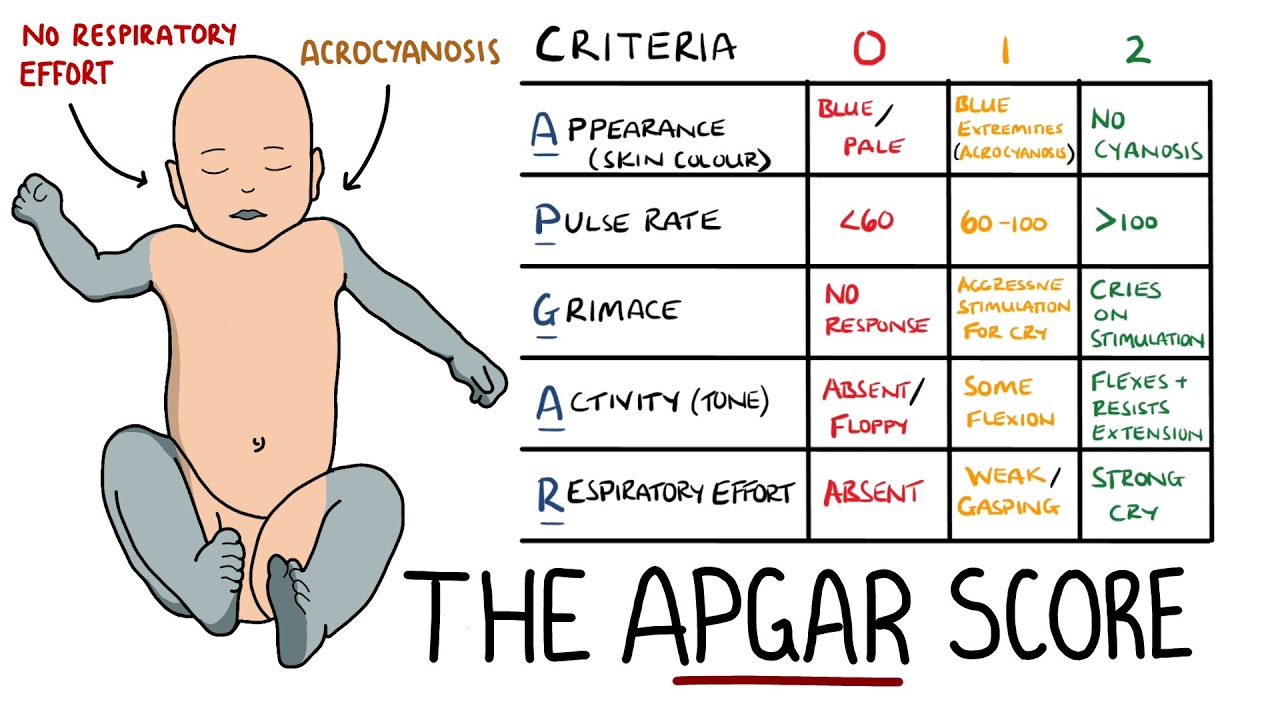 APGAR Score Made Easy - Newborn Assessment (APGAR Mnemonic)